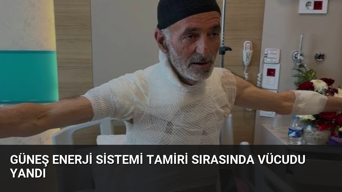 Güneş Enerji Sistemi Tamiri Sırasında Vücudu Yandı