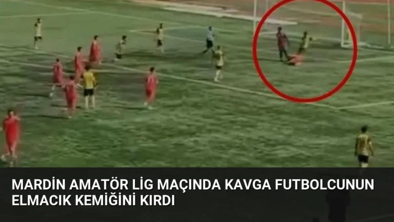 Mardin Amatör Lig Maçında Kavga Futbolcunun Elmacık Kemiğini Kırdı
